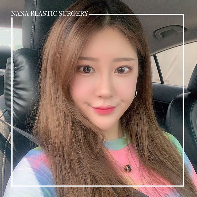 韩国nana整容医院郑美善院长