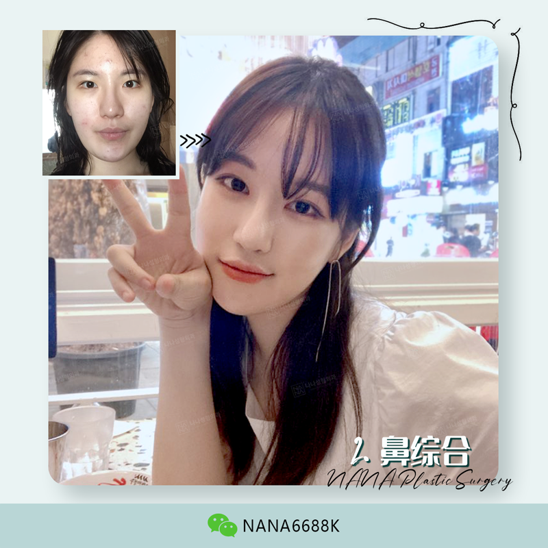 路人脸 高级脸的几个步骤