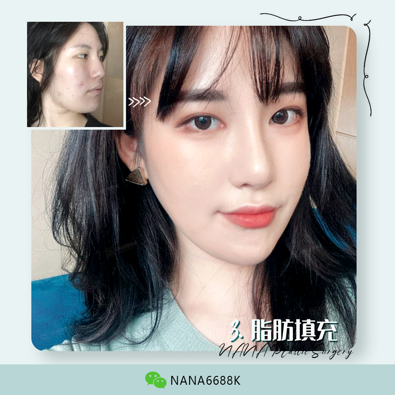 路人脸 高级脸的几个步骤