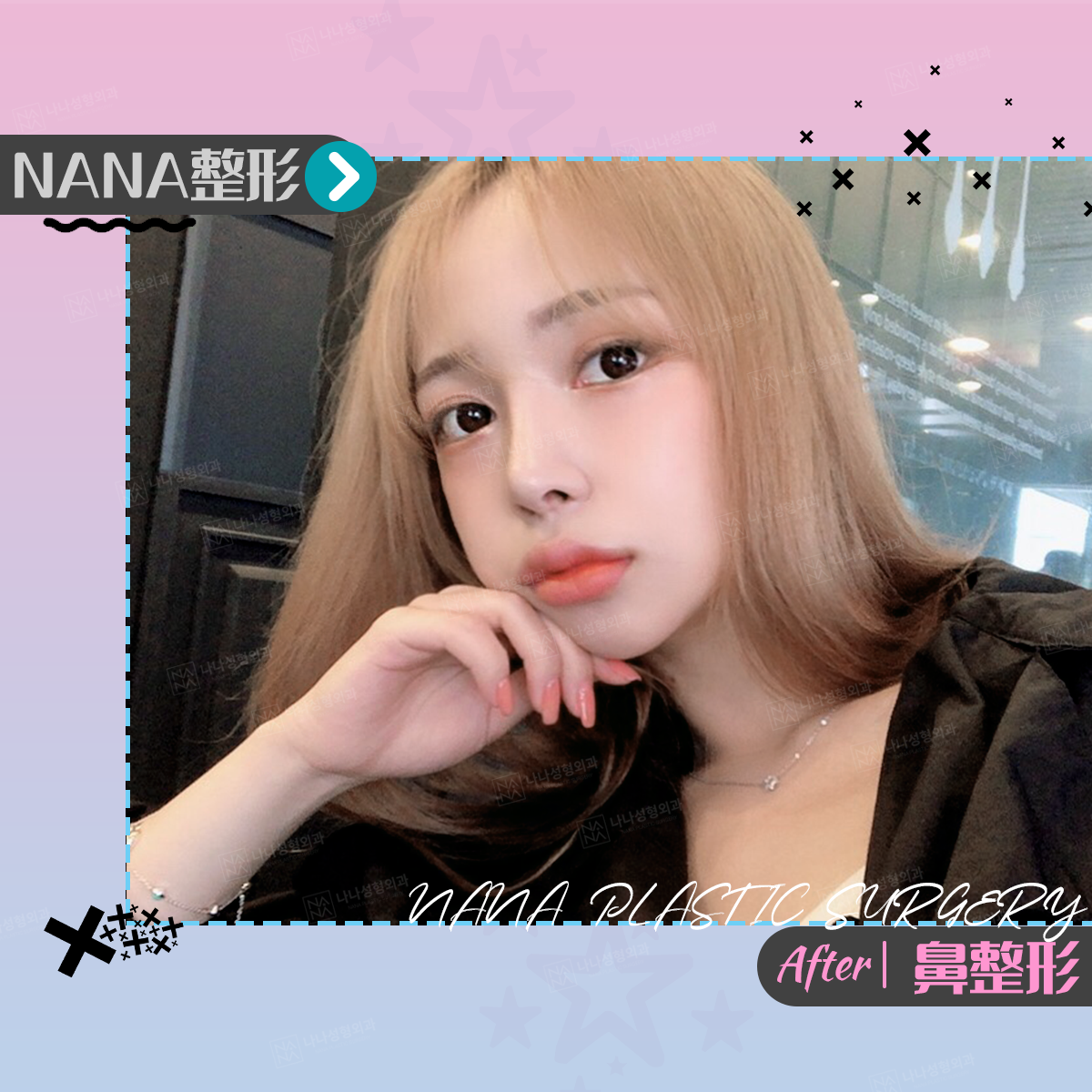 Nana出品零死角美鼻案例 Nana出品零死角美鼻案例