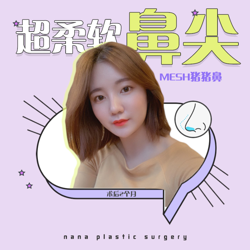 韩国nana整容医院afterschool成员nana世界级盛世美颜是整出来的