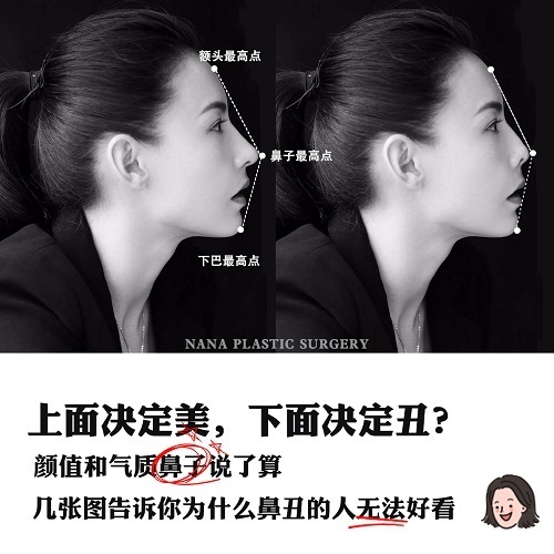 韩国整容整形 上半张脸决定美 下半张脸决定丑